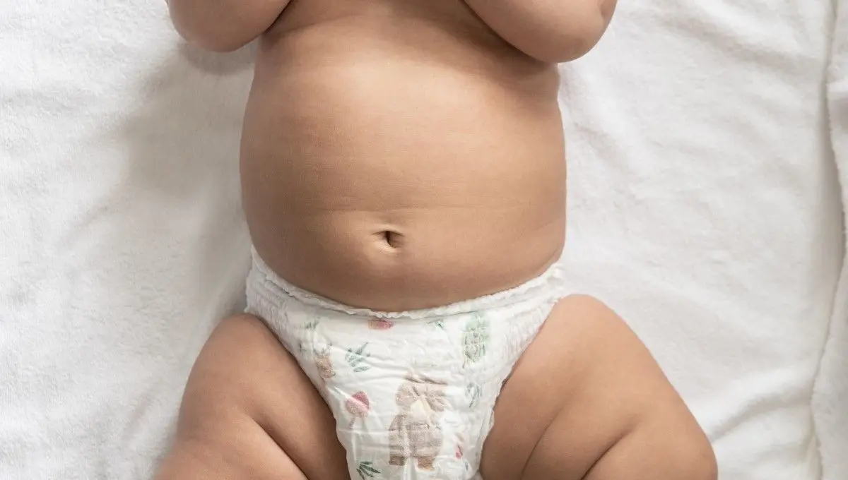 Hernia Umbilical en Bebés: Causas, Síntomas y Tratamiento - Cuándo requieren cirugía las hernias umbilicales en niños pequeños hernia umbilical en bebes - Cuándo requieren cirugía las hernias umbilicales en niños pequeños