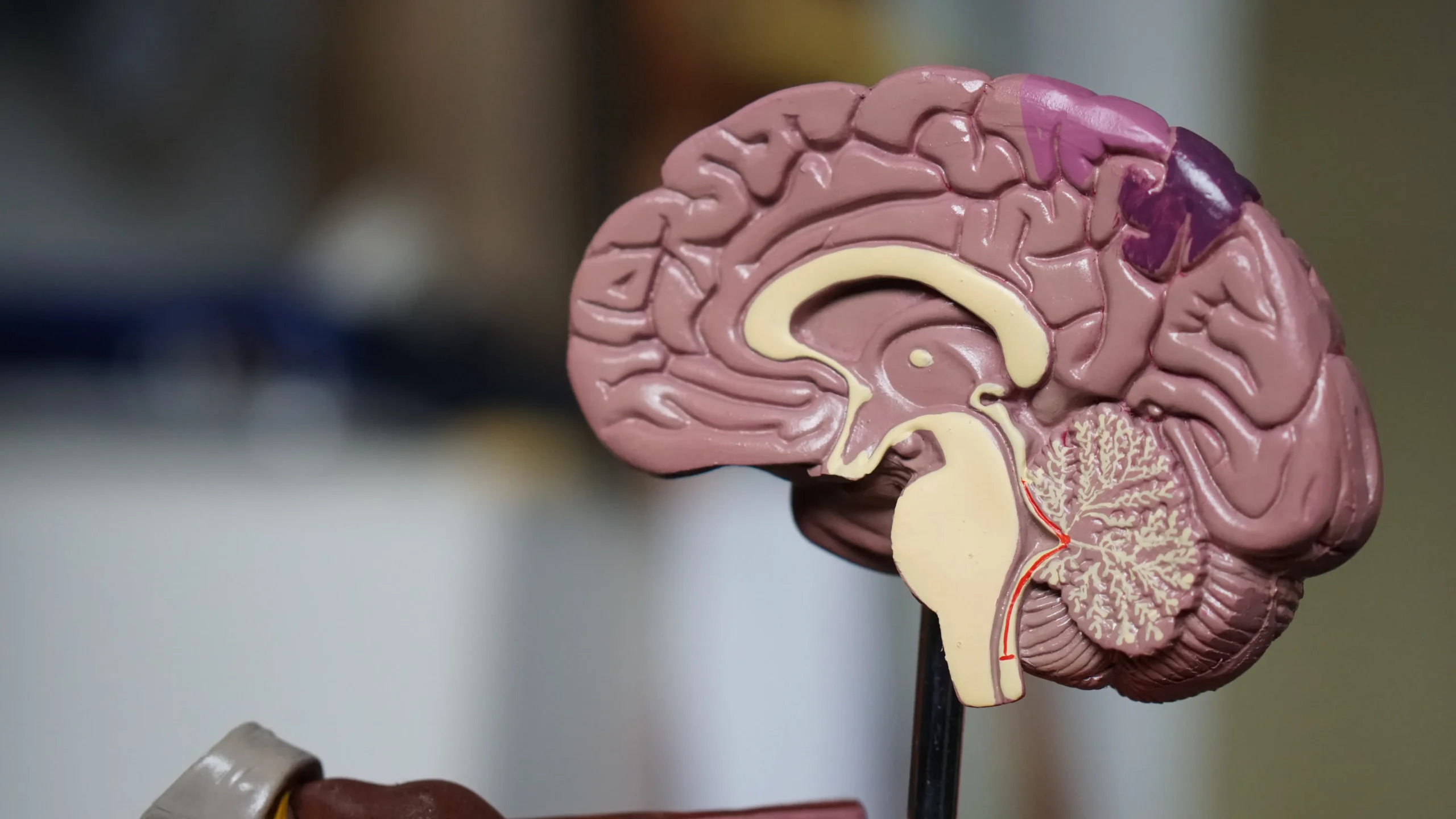 Tumores cerebrales benignos: ¿Cuándo es necesaria la cirugía? - Cuándo se debe operar un tumor benigno tumor cerebral benigno - Cuándo se debe operar un tumor benigno