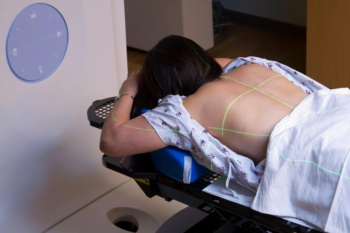 Cuánto dura una sesión de radioterapia: guía completa para pacientes - Cuántas sesiones de radioterapia son normales cuanto dura una sesion de radioterapia - Cuántas sesiones de radioterapia son normales