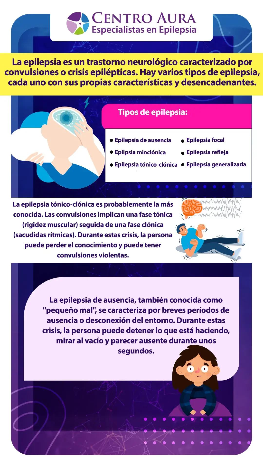 Epilepsia Focal: ¿Tiene Cura? Todo lo que Necesitas Saber - Cuánto dura una epilepsia focal epilepsia focal tiene cura - Cuánto dura una epilepsia focal