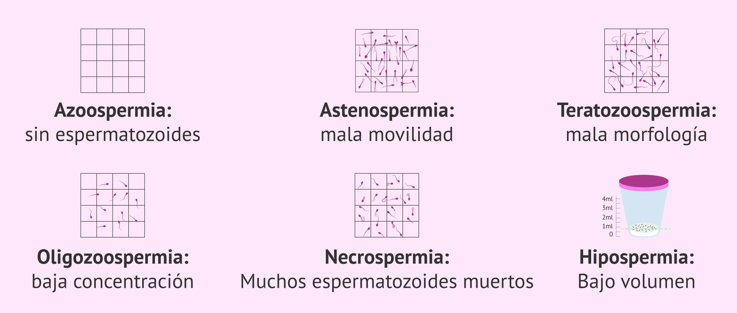 Cantidad de Espermatozoides para Embarazar: Guía Completa - Cuánto se necesita para embarazar a una mujer cantidad de espermatozoides para embarazar - Cuánto se necesita para embarazar a una mujer