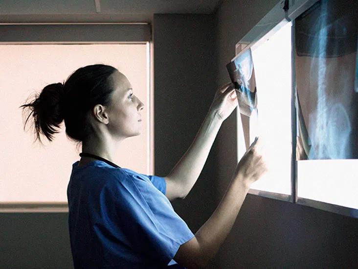 cancer de ovario diagnostico - Cuánto tarda en desarrollarse un cáncer de ovario