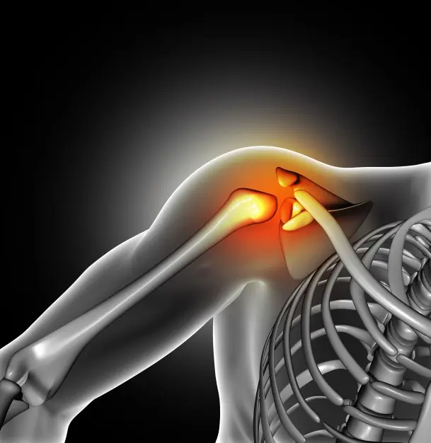 Dolor de Hombro Derecho: Causas, Síntomas y Tratamiento - Cuánto tiempo dura el dolor de hombro dolor en el hombro derecho - Cuánto tiempo dura el dolor de hombro