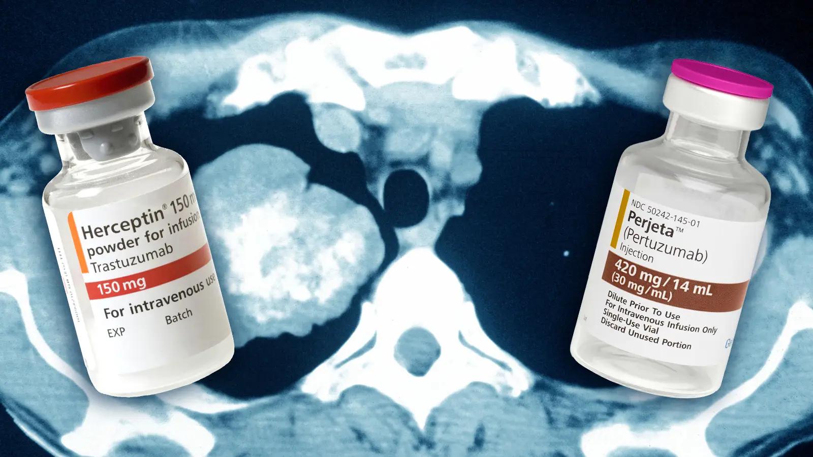 pertuzumab - Cuánto tiempo dura el tratamiento con trastuzumab