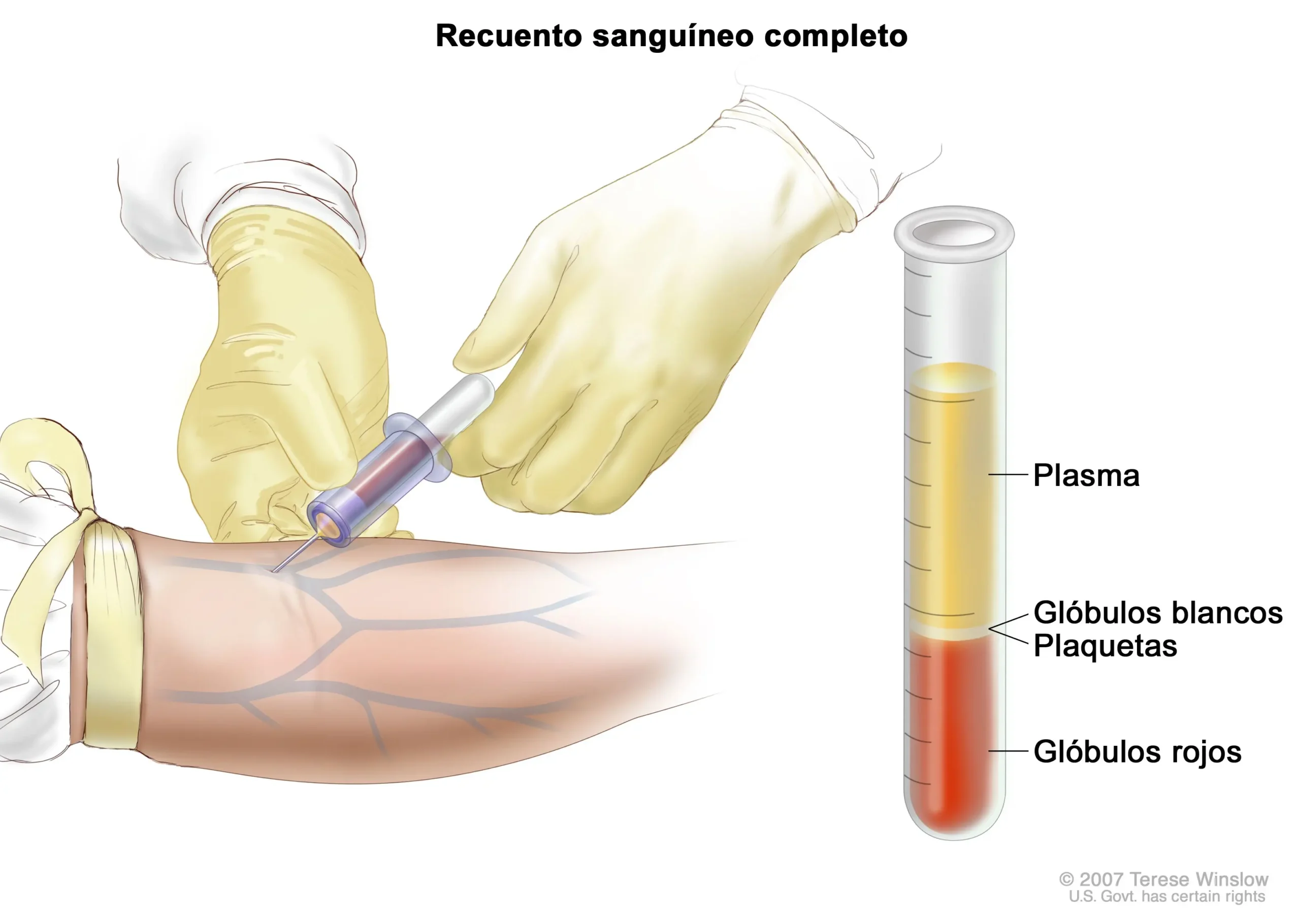 Tratamientos para la Leucemia: Una Guía Completa - Cuánto tiempo dura el tratamiento para la leucemia tratamientos para leucemia - Cuánto tiempo dura el tratamiento para la leucemia