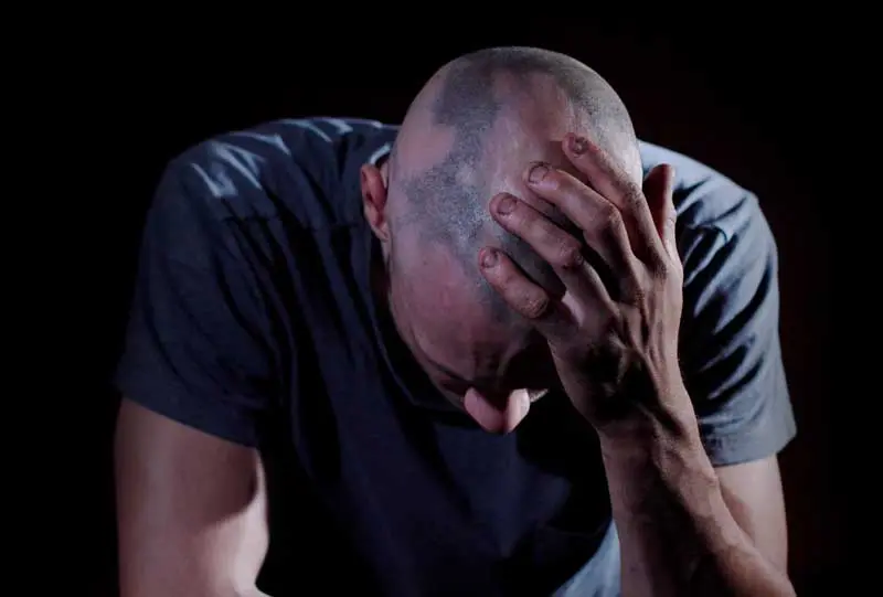 Alopecia Areata: Causas, Síntomas y Tratamiento - Cuánto tiempo dura la alopecia areata alopecia areata causas - Cuánto tiempo dura la alopecia areata