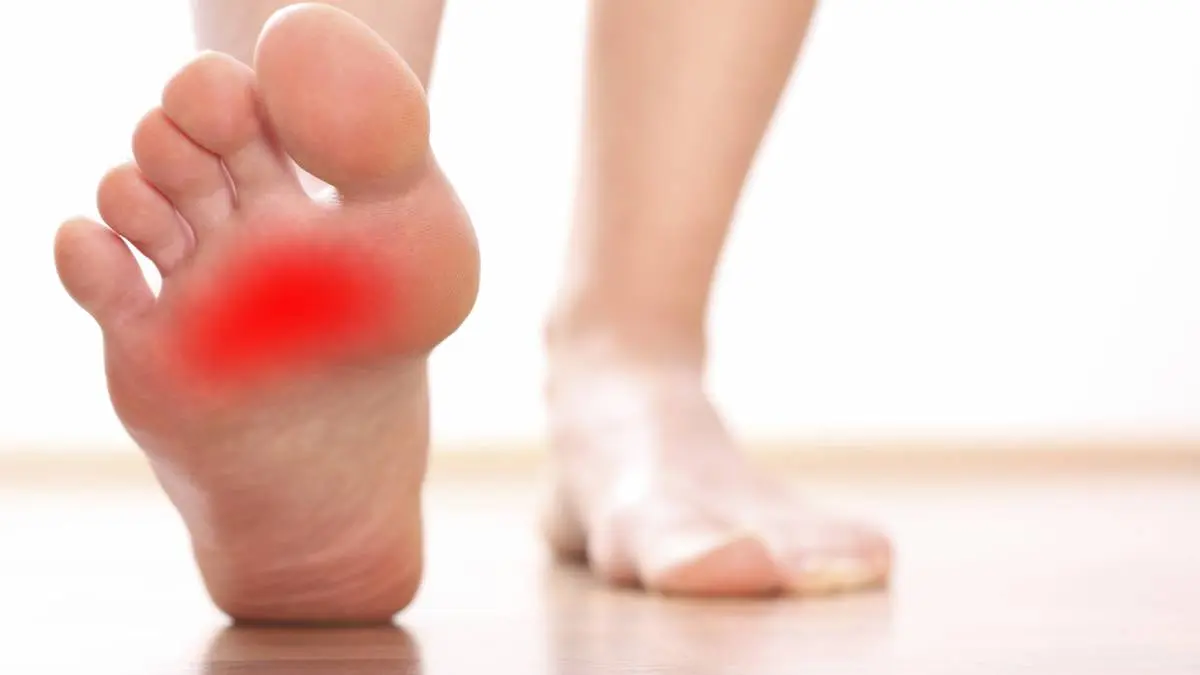 Fascitis Plantar: Causas, Tratamiento y Prevención - Cuánto tiempo dura la fascitis plantar dolor en la planta del pie - Cuánto tiempo dura la fascitis plantar