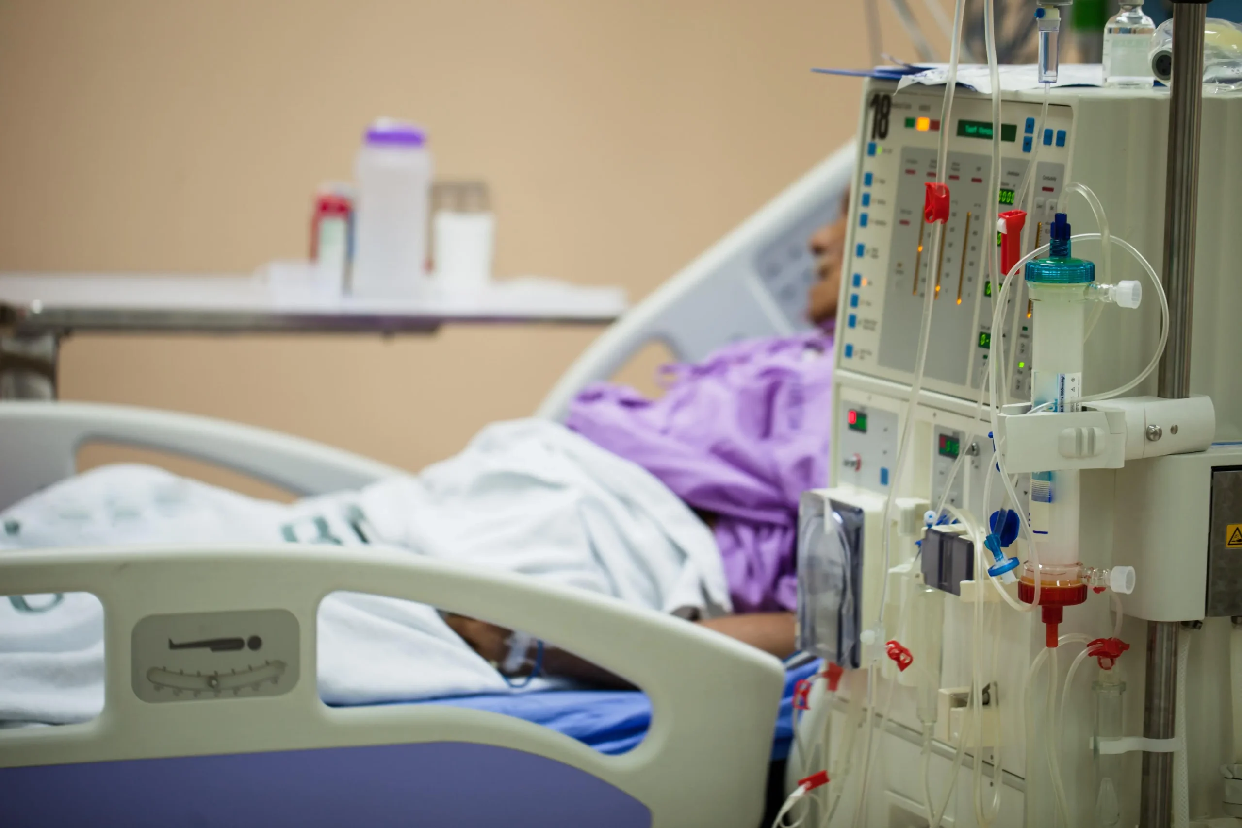 La diálisis: Una guía completa para entender y gestionar este tratamiento renal - Cuánto tiempo dura una diálisis dialisis - Cuánto tiempo dura una diálisis