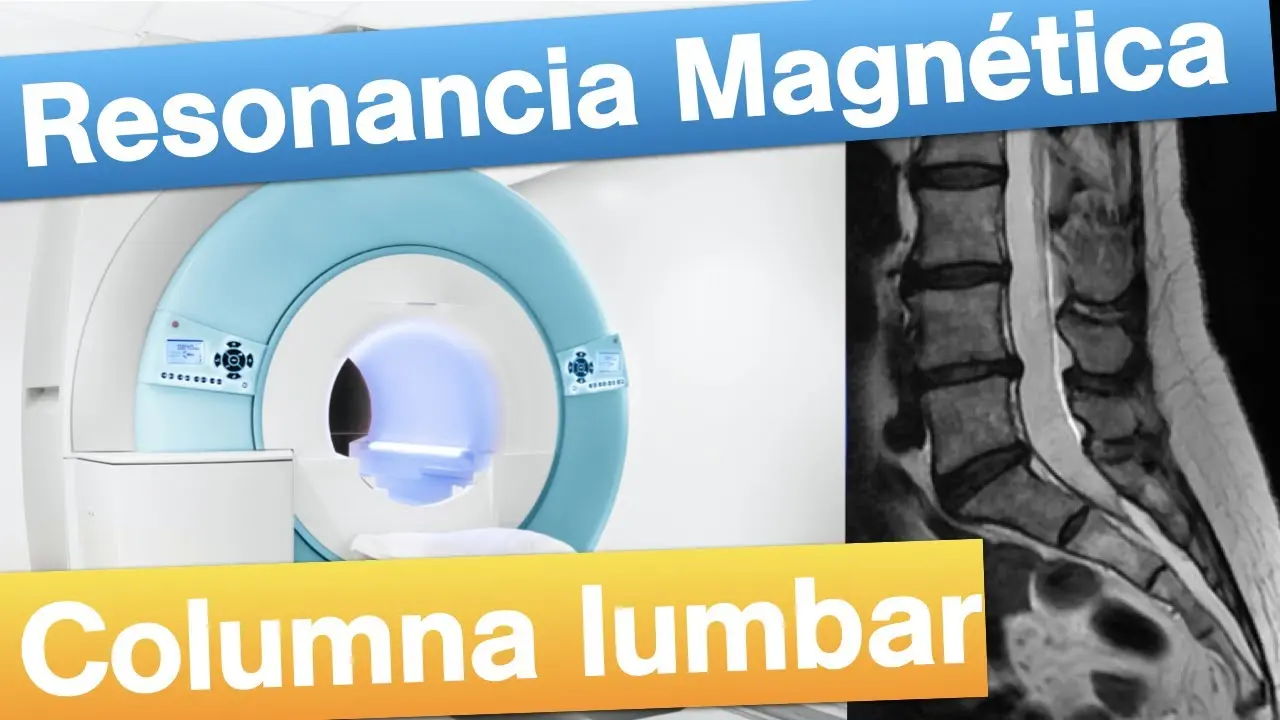 Resonancia Magnética Lumbosacra: Todo lo que necesitas saber - Cuánto tiempo dura una resonancia magnética lumbosacra resonancia magnetica lumbosacra - Cuánto tiempo dura una resonancia magnética lumbosacra