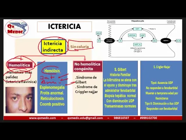 Ictericia en Adultos: Causas, Síntomas y Duración - Cuánto tiempo tarda en desaparecer la ictericia en adultos sindrome icterico - Cuánto tiempo tarda en desaparecer la ictericia en adultos