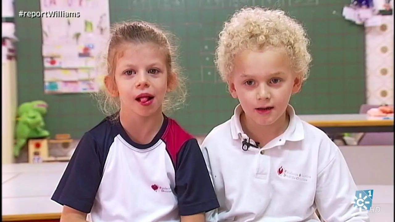Famosos con Síndrome de Williams: Vivencias e Impacto - Cuánto viven las personas con Williams sindrome de williams famosos - Cuánto viven las personas con Williams