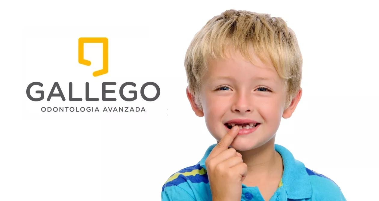 Dentadura de un niño: Guía completa para padres - Cuántos dientes se le caen a un niño dentadura de un niño - Cuántos dientes se le caen a un niño