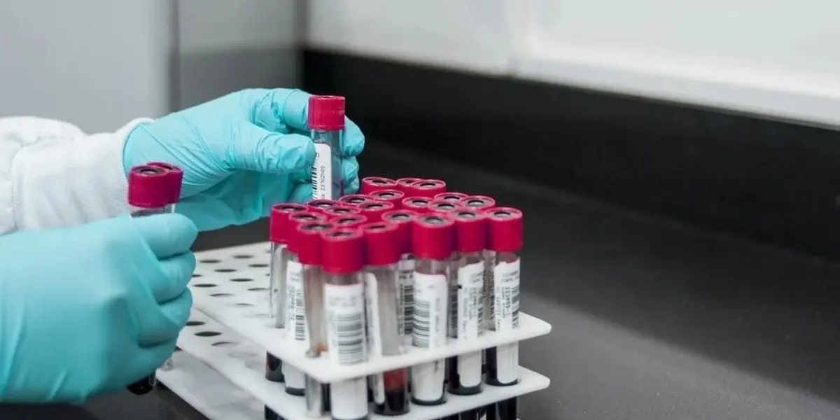 Extracción de Sangre: Tipos, Procedimiento y Cuidados - Cuántos tipos de extracción de sangre hay extraccion de sangre - Cuántos tipos de extracción de sangre hay