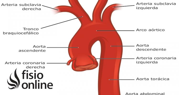 Anatomía básica de la circulación cerebral para el cardiólogo intervencionista - Dónde nace la arteria carótida común arteria carotida común - Dónde nace la arteria carótida común