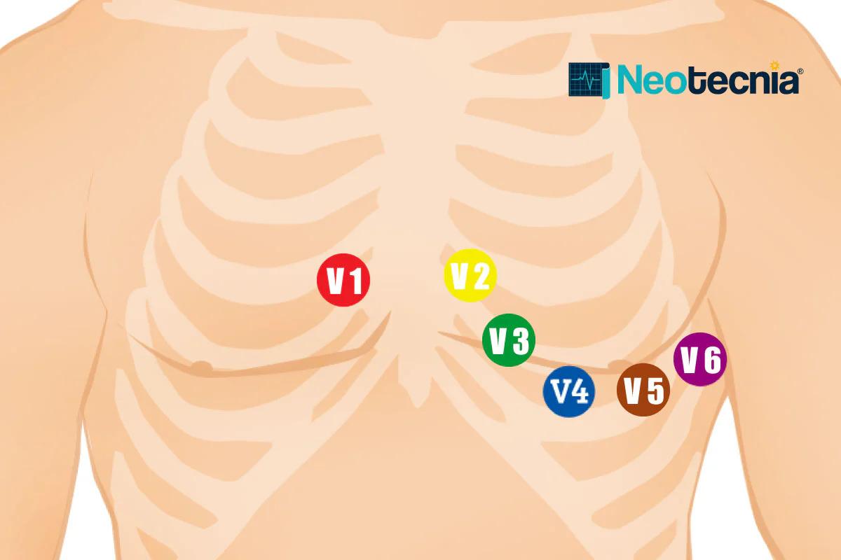 Colocación de Electrodos para un Electrocardiograma en Mujeres: Guía Completa - Dónde se colocan los electrodos para un electrocardiograma mujer electrocardiograma electrodos mujer - Dónde se colocan los electrodos para un electrocardiograma mujer