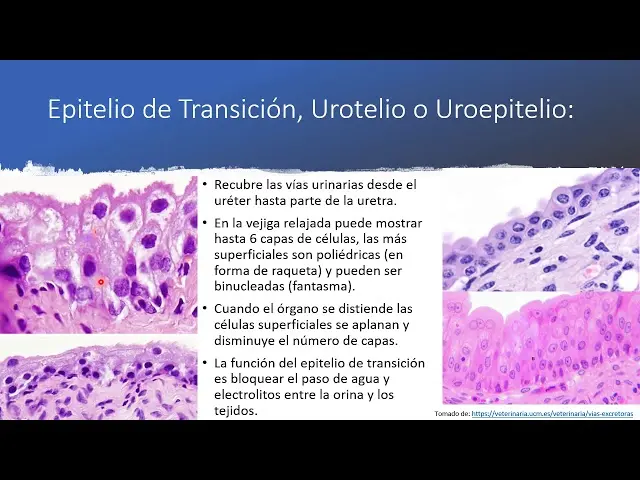 Epitelio de Transición: Estructura, Función y Localización - Dónde se encuentra el epitelio de transición epitelio de transicion - Dónde se encuentra el epitelio de transición