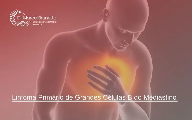 Linfoma de mediastino: Diagnóstico, tratamiento y esperanza - El linfoma mediastínico es curable linfoma de mediastino - El linfoma mediastínico es curable