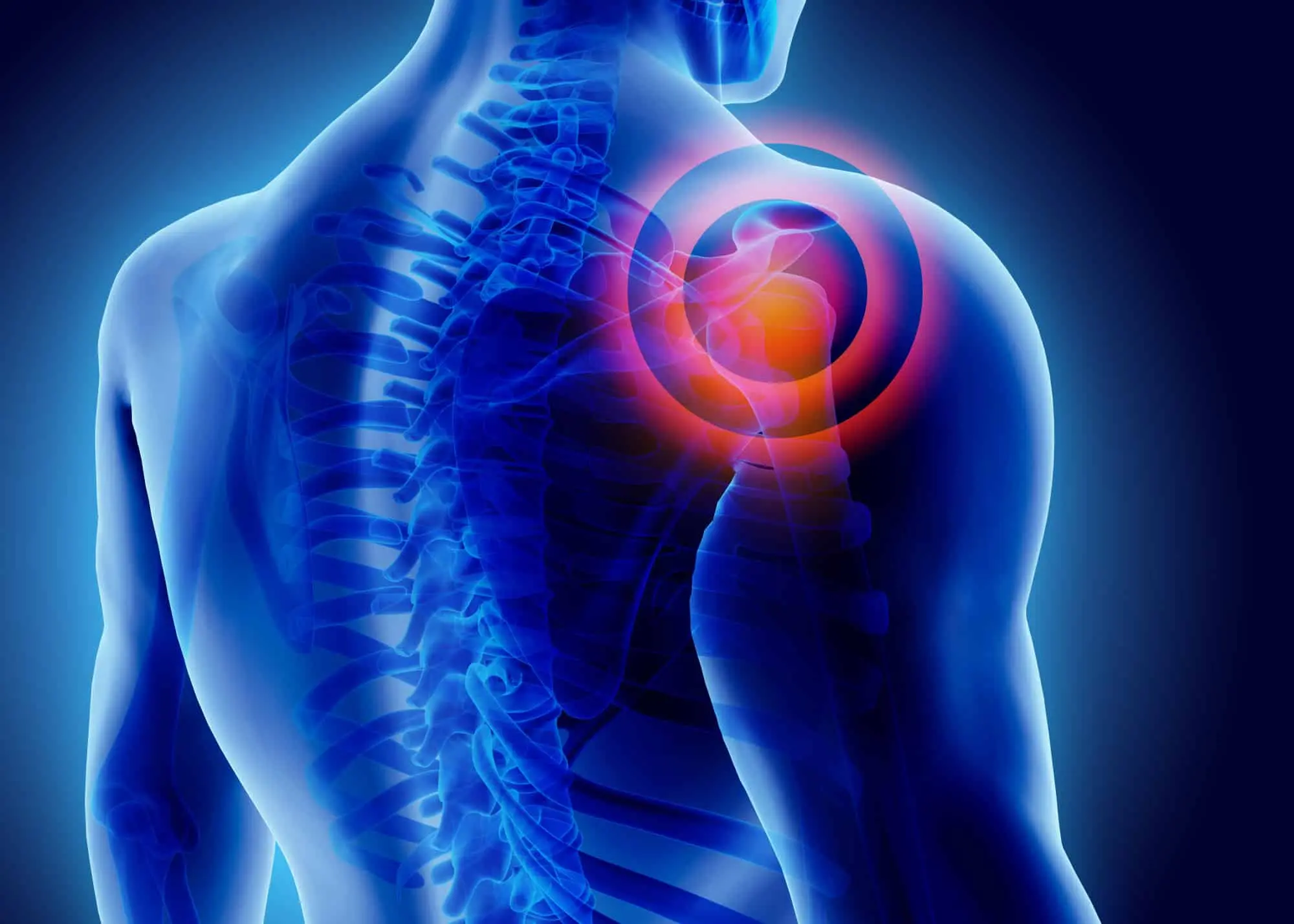 Dolor en Ambos Hombros: Causas, Síntomas y Tratamiento - Por qué duelen ambas articulaciones del hombro dolor en ambos hombros - Por qué duelen ambas articulaciones del hombro