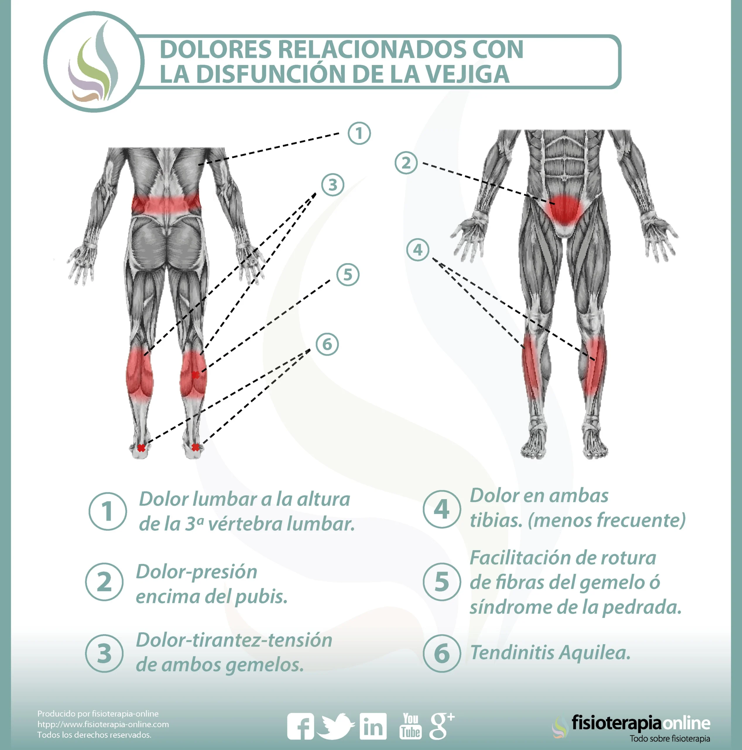 Dolor de Espalda Baja y Piernas Cansadas: Causas, Tratamientos y Consejos - Por qué me duele la espalda y me siento cansada dolor de espalda baja y piernas cansadas - Por qué me duele la espalda y me siento cansada