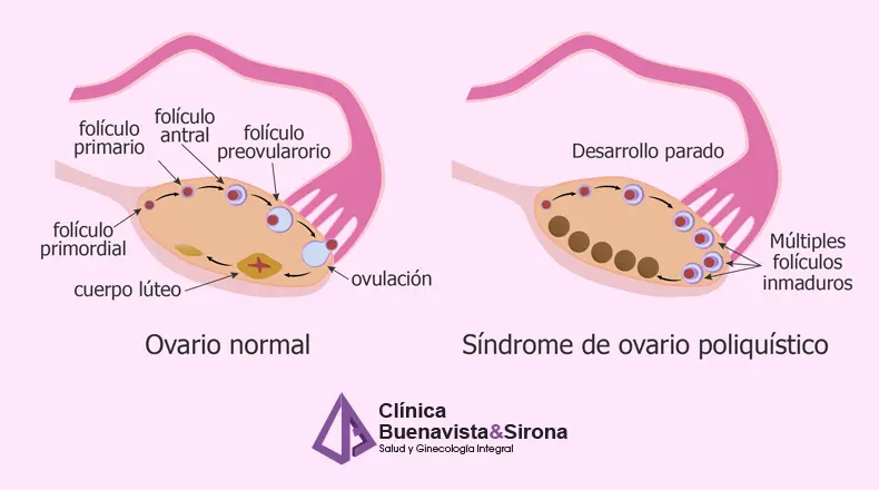 porque no me quedo embarazada - Por qué no quedo embarazada si ya tengo un hijo