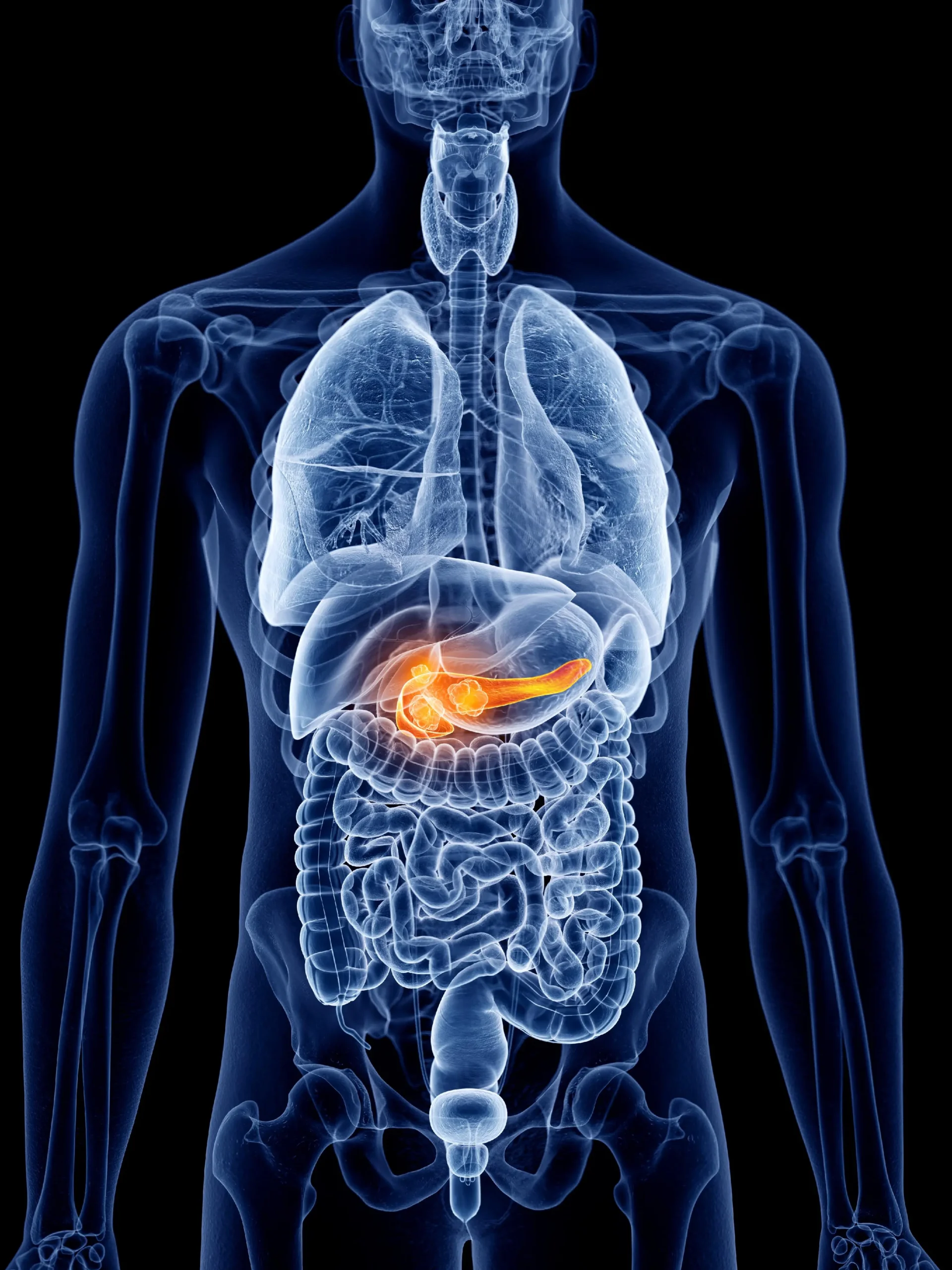 Pancreatitis en perros: Síntomas, causas, tratamiento y alimentación - Por qué se da la pancreatitis pancreatitis en perros - Por qué se da la pancreatitis