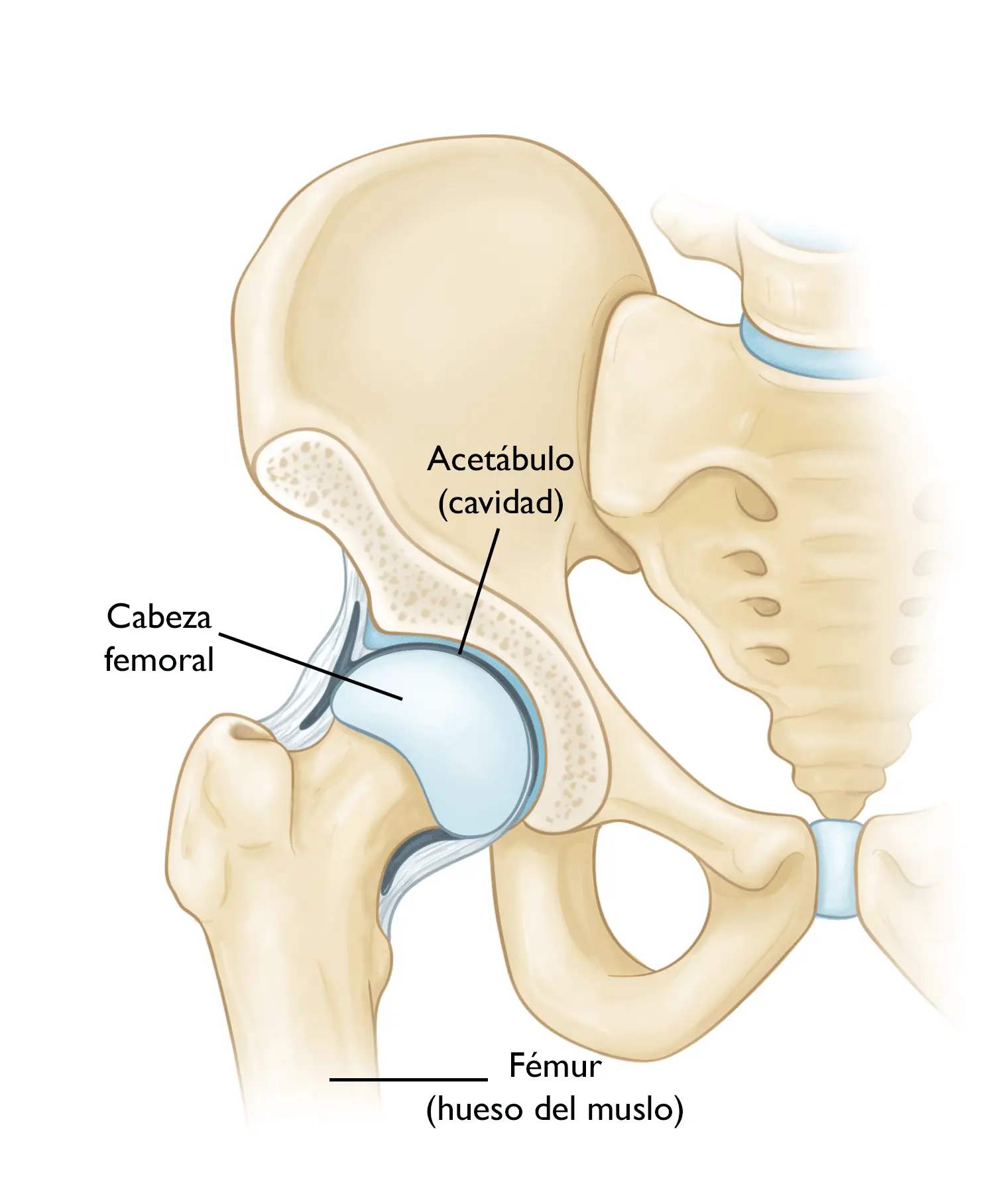 Artroplastia Total de Cadera: Guía Completa para Pacientes - Por qué se realiza una artroplastia de cadera artroplastia total de cadera - Por qué se realiza una artroplastia de cadera