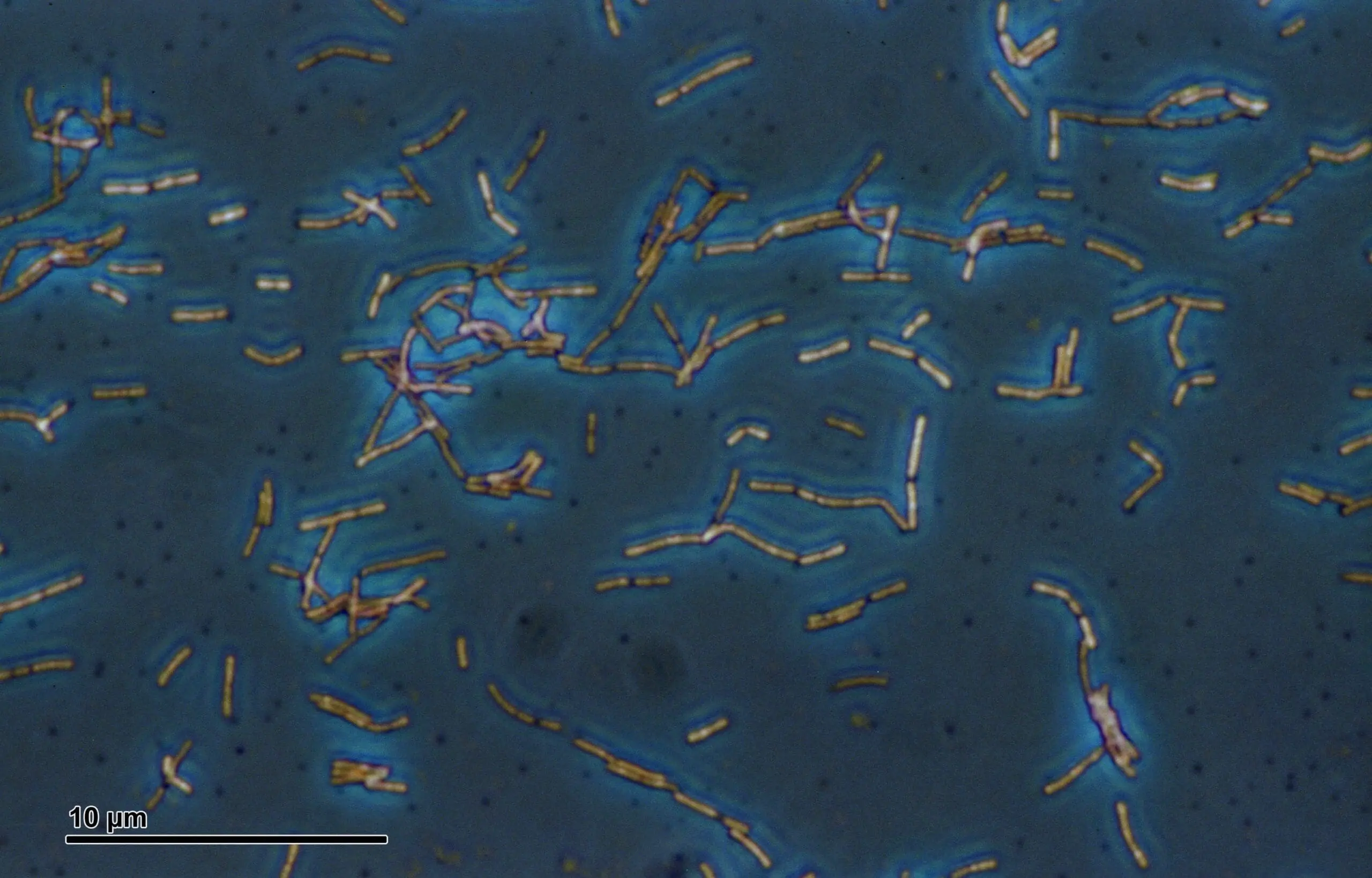 Acidophilus: Beneficios, Alimentos y Cómo Tomar Este Probiótico - Qué alimentos contienen acidophilus bacillus acidophilus - Qué alimentos contienen acidophilus