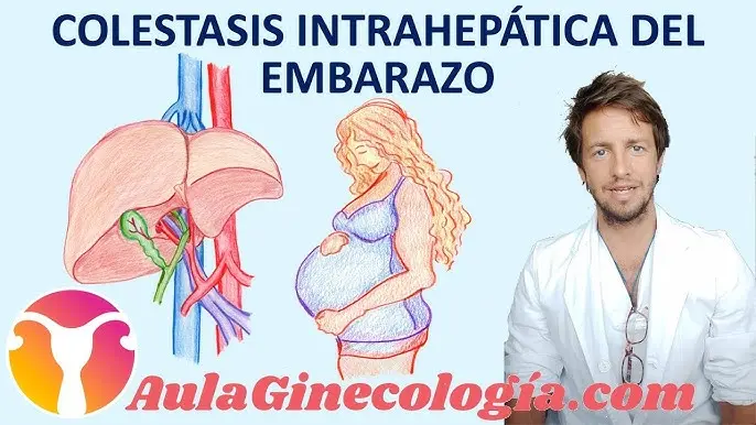 Colestasis del Embarazo: Alimentación y Cuidados para Aliviar los Síntomas - Qué alimentos producen colestasis que es colestasis - Qué alimentos producen colestasis