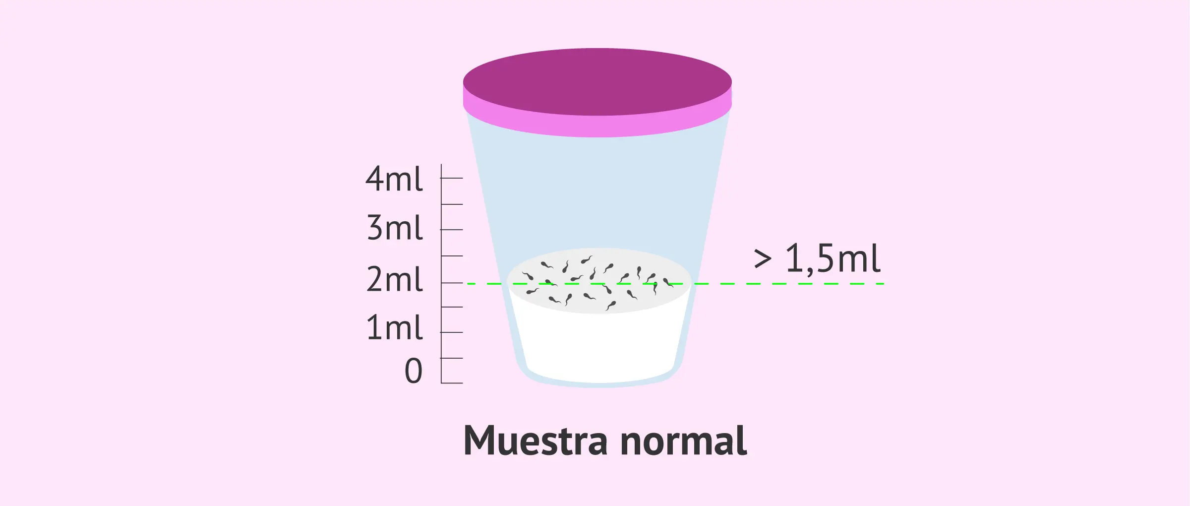 Cantidad de Espermatozoides para Embarazar: Guía Completa - Qué cantidad de espermatozoides es considerada como infértil cantidad de espermatozoides para embarazar - Qué cantidad de espermatozoides es considerada como infértil