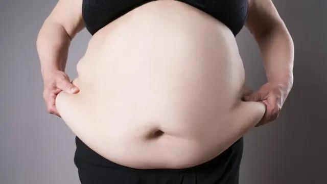 Sobrepeso y Obesidad: Comprender los Riesgos y Cómo Abordarlos - Qué características tiene una persona con sobrepeso personas gordas - Qué características tiene una persona con sobrepeso