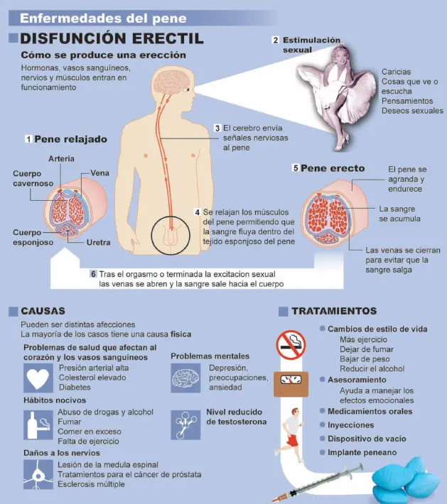 Dejar de fumar mejora tu erección: Beneficios para la salud sexual masculina - Qué causa el cigarro en los hombres en la intimidad si dejo de fumar mejora mi ereccion - Qué causa el cigarro en los hombres en la intimidad