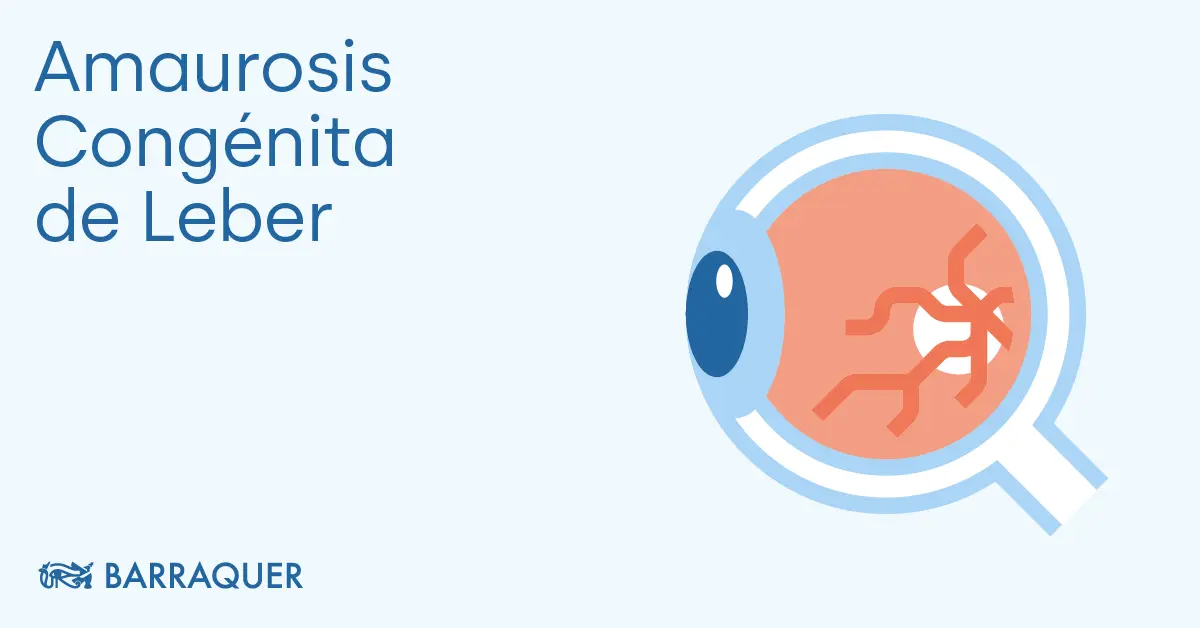 Amaurosis Congénita de Leber: Causas, Síntomas y Diagnóstico - Qué causa la amaurosis congénita de Leber amaurosis congenita de leber - Qué causa la amaurosis congénita de Leber