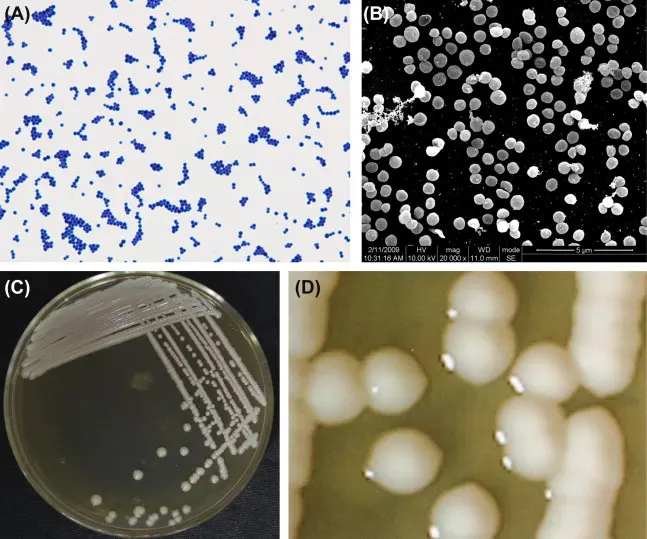 Staphylococcus epidermidis: Una bacteria común con implicaciones clínicas - Qué causa la bacteria Staphylococcus epidermidis epidermidis - Qué causa la bacteria Staphylococcus epidermidis