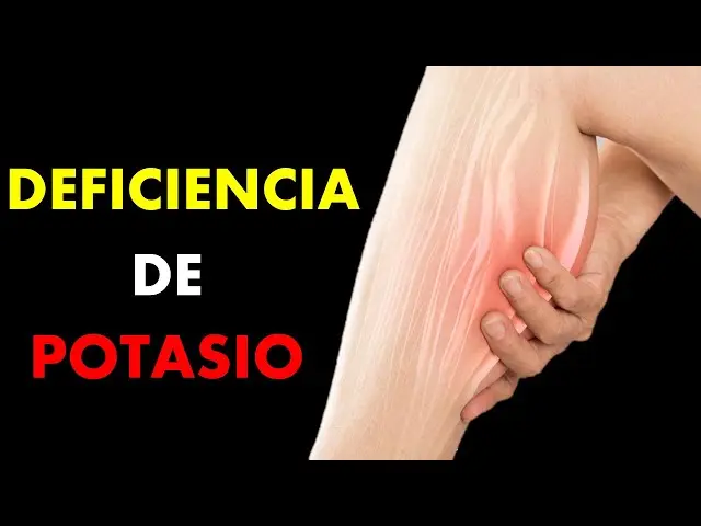 Causas de la Pérdida de Potasio en el Cuerpo Humano - Qué causa la pérdida de potasio en el cuerpo humano que provoca la falta de potasio - Qué causa la pérdida de potasio en el cuerpo humano