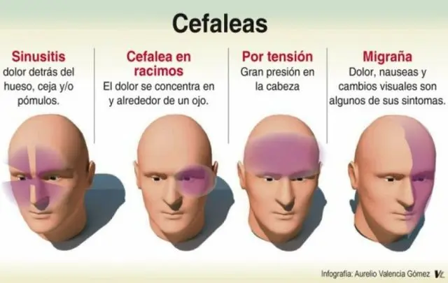Dolor de Cabeza en Racimo: Todo lo que Necesitas Saber - Qué consecuencias trae la cefalea en los racimos dolor de cabeza en racimo - Qué consecuencias trae la cefalea en los racimos