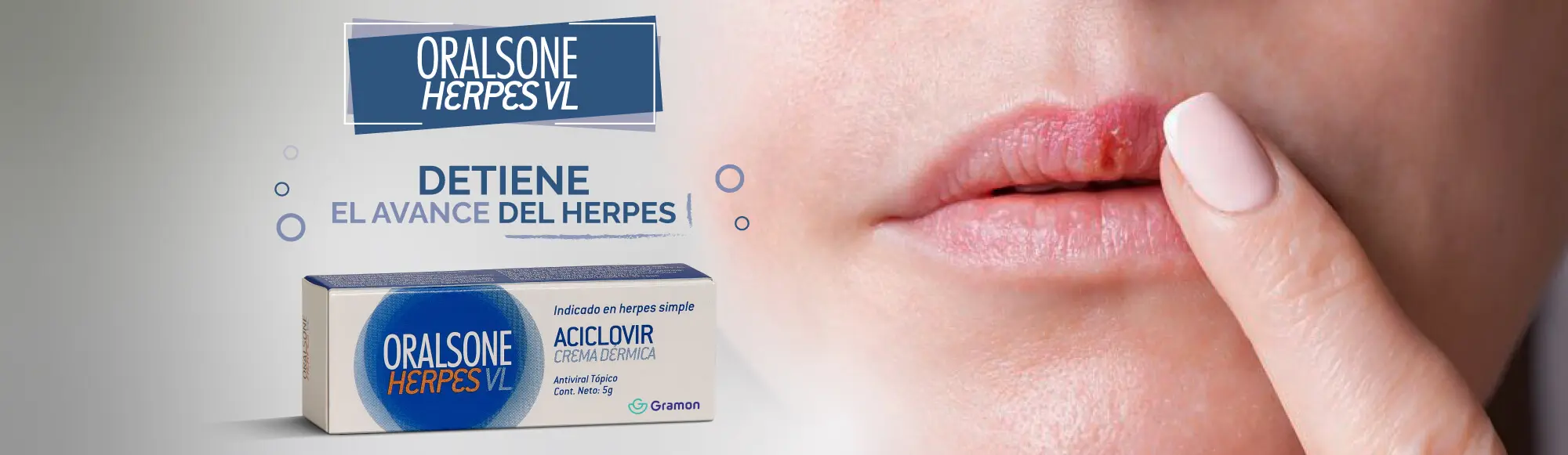 Oralsone para el Herpes: ¿Es Efectivo? Todo lo que Debes Saber - Qué cura el oralsone oralsone herpes - Qué cura el oralsone