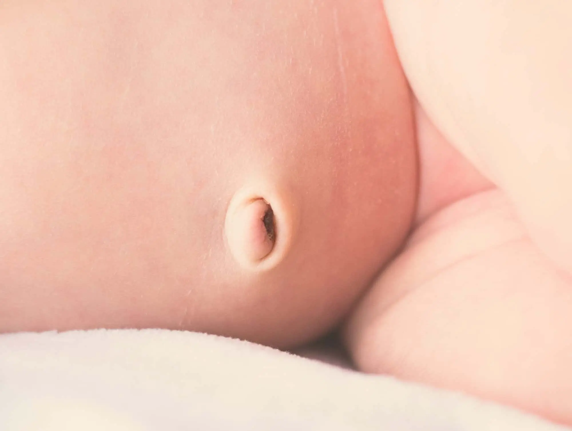 Hernia Umbilical en Bebés: Causas, Síntomas y Tratamiento - Qué debo hacer si mi bebé tiene hernia umbilical hernia umbilical en bebes - Qué debo hacer si mi bebé tiene hernia umbilical