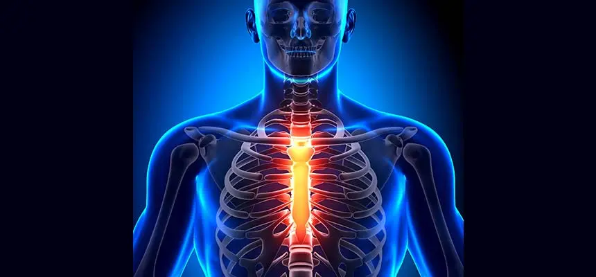 Osteocondritis Disecante: Causas, Síntomas y Tratamiento - Qué debo hacer si tengo osteocondritis osteocondritis pecho - Qué debo hacer si tengo osteocondritis