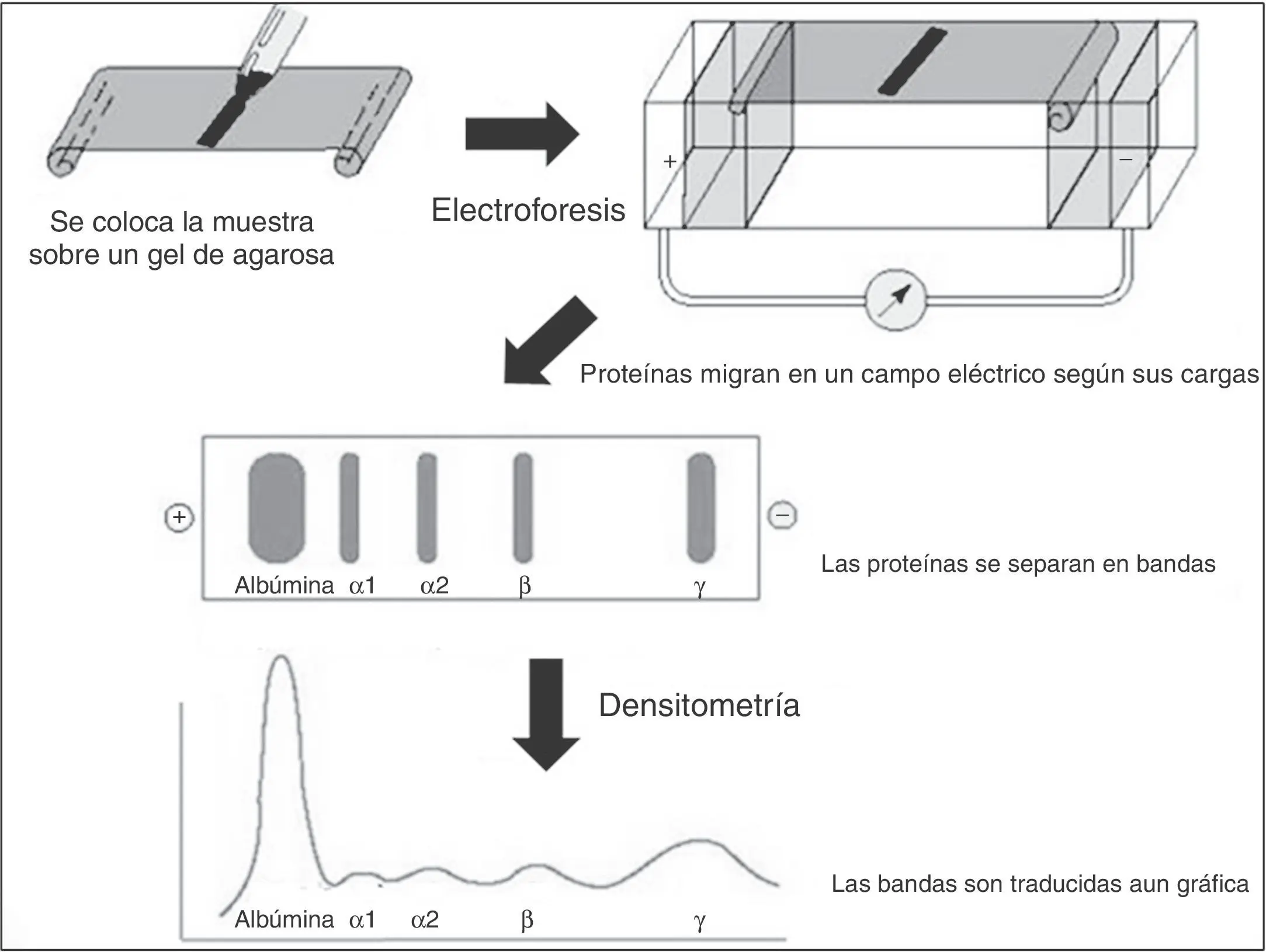 Análisis de Inmunofijación: Una Guía Completa - Qué detecta la inmunoelectroforesis estudio por inmunofijacion - Qué detecta la inmunoelectroforesis