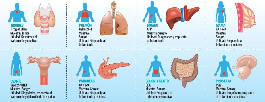 cea marcador tumoral - Qué diagnóstico es CEA