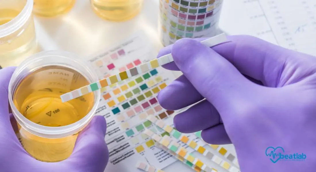 Diferencia entre examen de orina y urocultivo: Una guía completa - Qué diferencia hay entre un examen general de orina y un urocultivo diferencia entre examen de orina y urocultivo - Qué diferencia hay entre un examen general de orina y un urocultivo