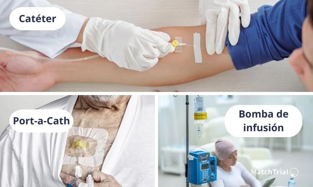 Quimioterapia Endovenosa: Todo lo que necesitas saber - Qué efectos tiene la quimioterapia oral quimioterapia endovenosa - Qué efectos tiene la quimioterapia oral