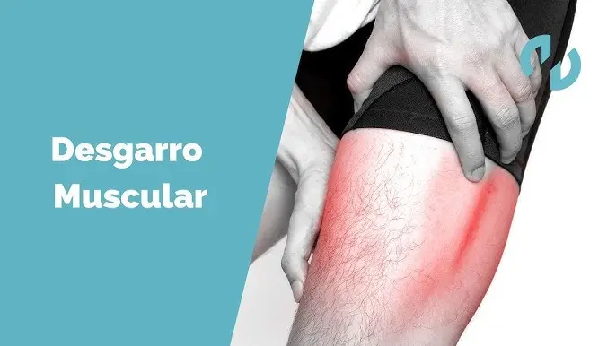 Cómo Curar un Desgarro Muscular: Guía Completa de Fisioterapia - Qué ejercicios hacer para recuperarse de un desgarro muscular como curar un desgarro - Qué ejercicios hacer para recuperarse de un desgarro muscular