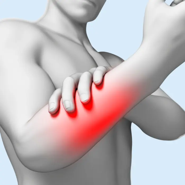 porque me duelen los brazos por dentro - Qué enfermedad hace doler los brazos