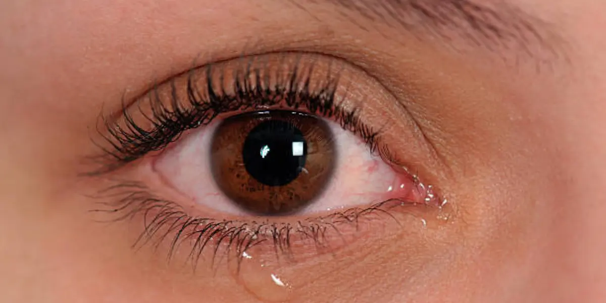 Ojos llorosos: causas, tratamiento y remedios caseros - Qué enfermedad provoca ojos llorosos ojos llorosos - Qué enfermedad provoca ojos llorosos