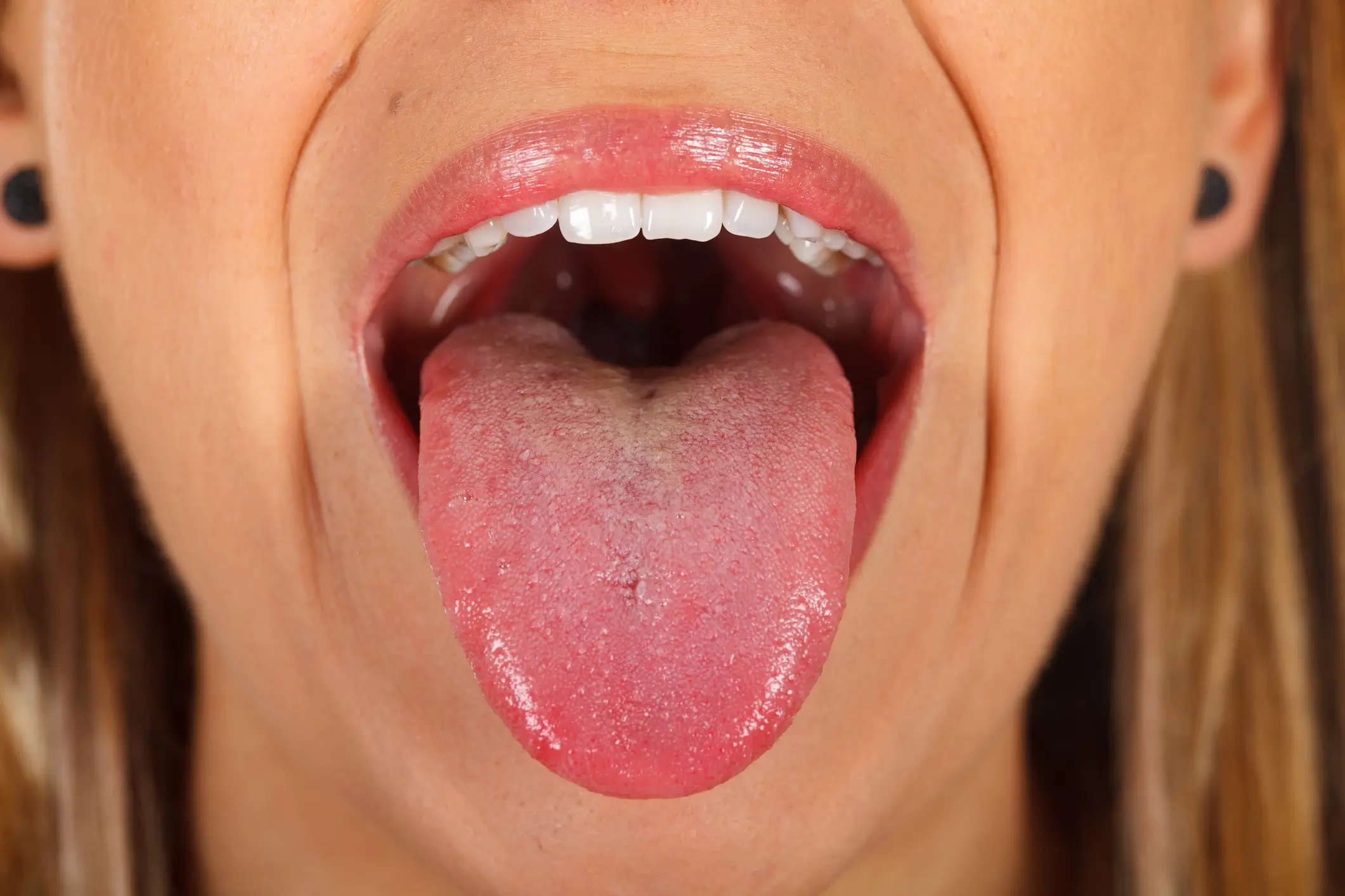 Enfermedades de la lengua: causas, síntomas y tratamiento - Qué enfermedades le puede dar a la lengua lengua covid - Qué enfermedades le puede dar a la lengua