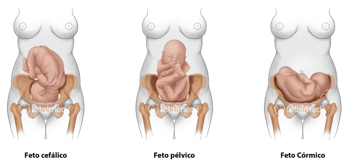 Cefálico: Un término con múltiples significados en salud - Qué es el cefálico cefalico - Qué es el cefálico