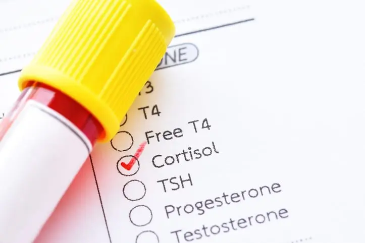 Cortisol Plasmático: Una Guía Completa para Entender Su Importancia - Qué es el cortisol plasmático cortisol plasmatico - Qué es el cortisol plasmático