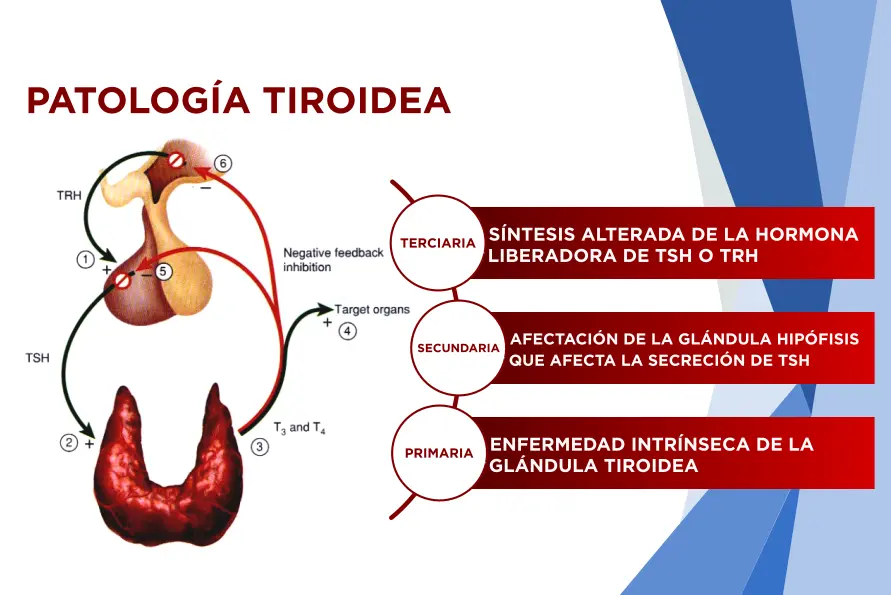 Anticuerpos Antitiroideos: ¿Qué son y por qué son importantes? - Qué es el examen anticuerpos antitiroideos anticuerpos tiroideos - Qué es el examen anticuerpos antitiroideos