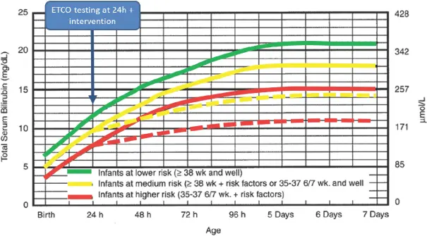 Curva de Bilirrubina Neonatal: Una Guía para la Salud del Recién Nacido - Qué es la curva de Bhutani curva de bilirrubina neonatal - Qué es la curva de Bhutani